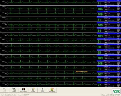 Criticare VitalView Central Station Software